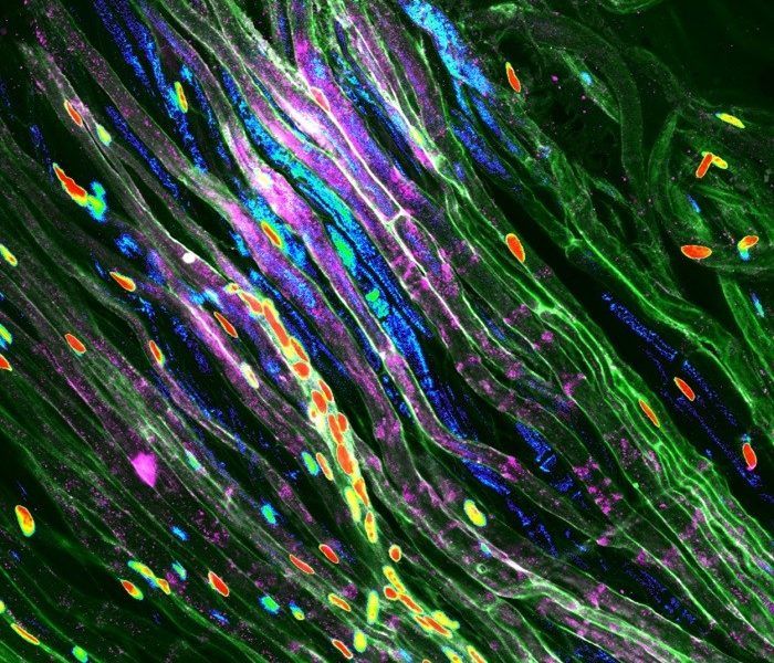 Danno neurologico: la risposta è differente tra maschi e femmine