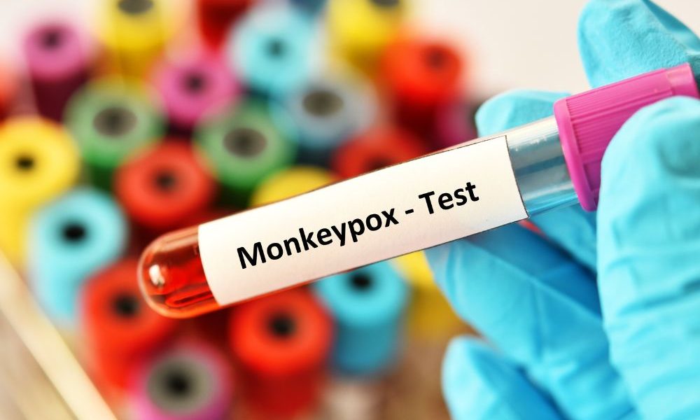 Mpox, l’Oms revoca lo stato di emergenza globale: resta attenzione in Africa