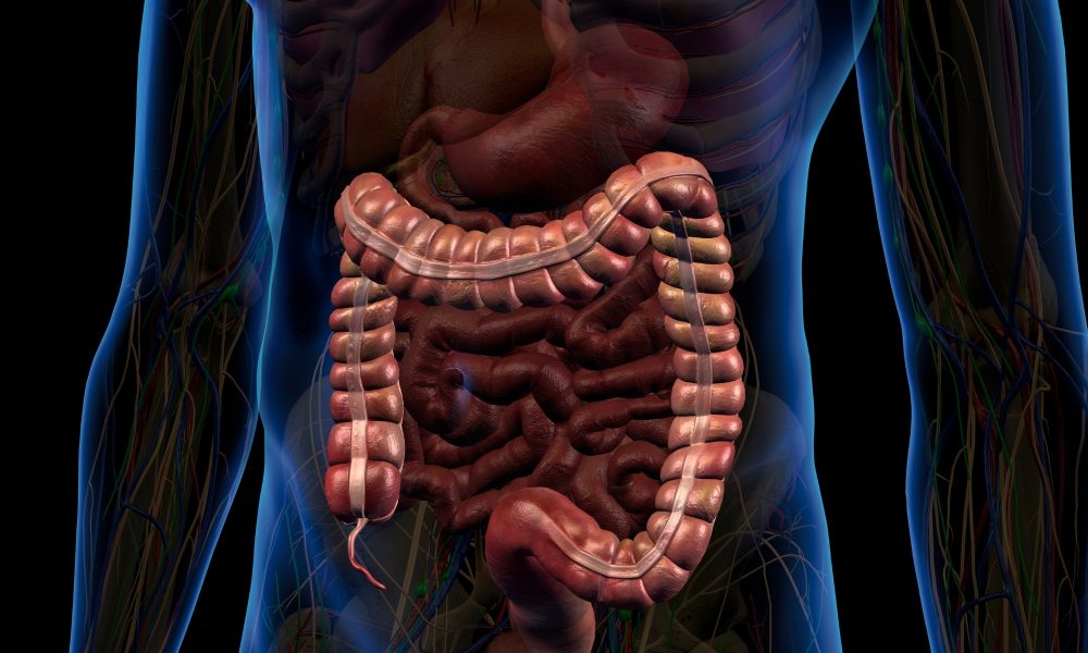 Crohn, nuova terapia rimborsabile: Aifa dà il via libera a mirikizumab