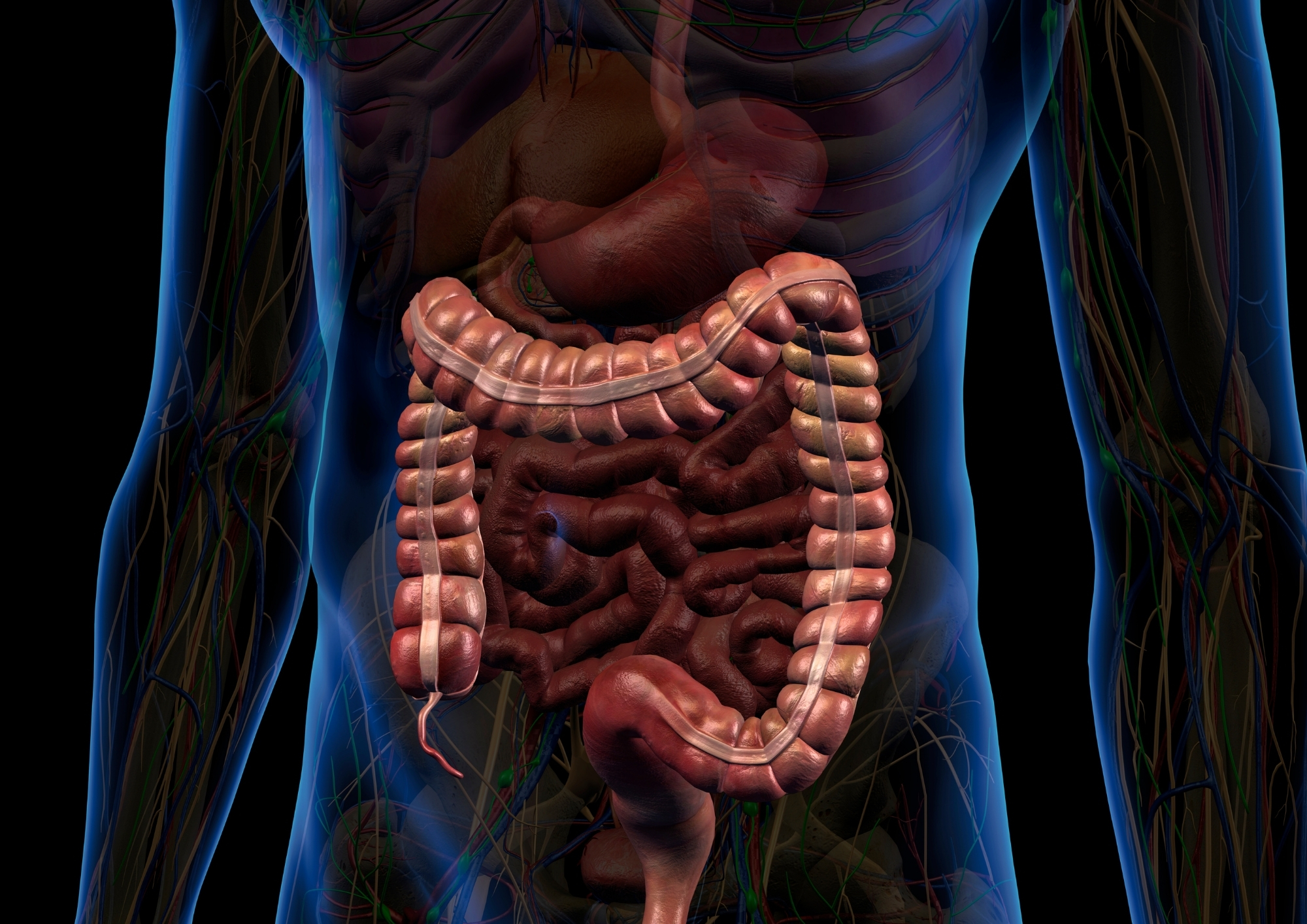 Crohn, nuova terapia rimborsabile: Aifa dà il via libera a mirikizumab